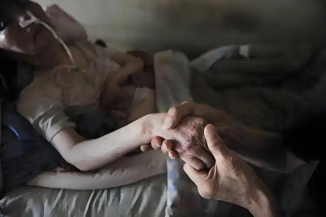 三种眼震类型：阴虚风动、肝郁气滞、肝火旺！中医调肝方法各有讲